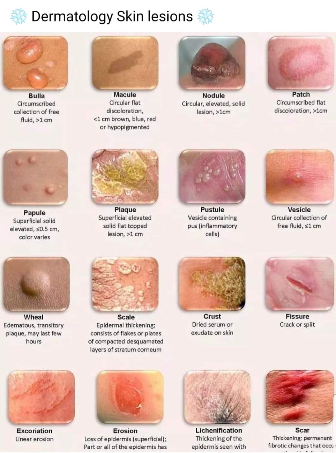 Dermatology Skin Lesions