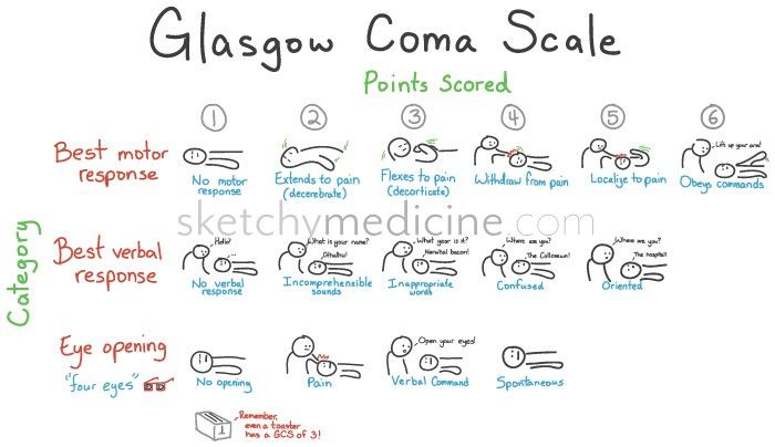 GCS Glasgow Coma Scale