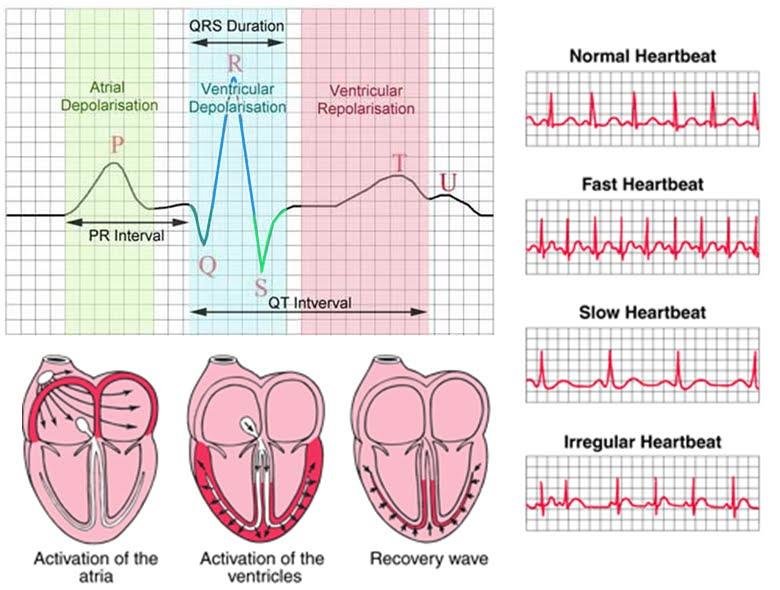 PQRS ECG Rhythm SetelDoc